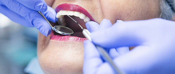 Best Emergency Dentist for Lost Fillings or Crowns in Armada, MI
